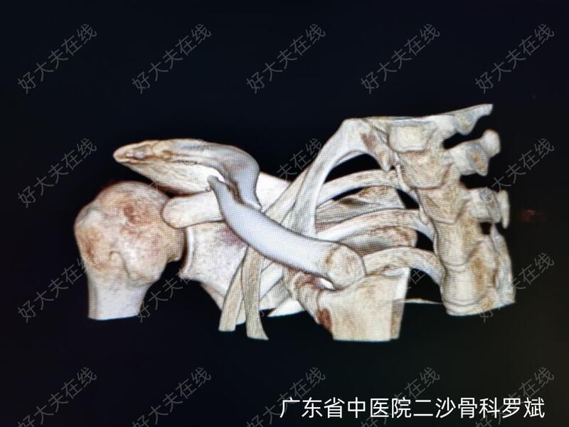圖文圖片