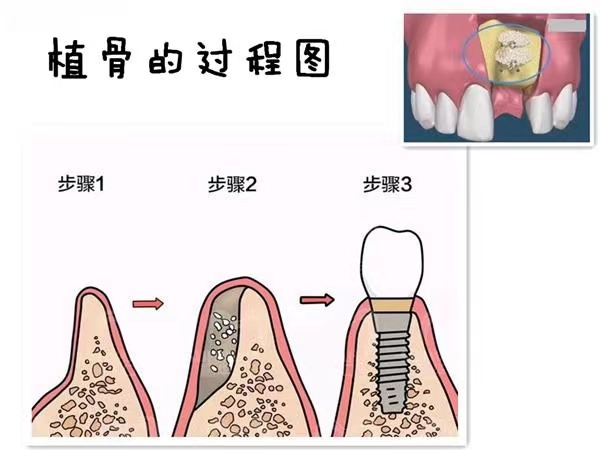 圖文圖片