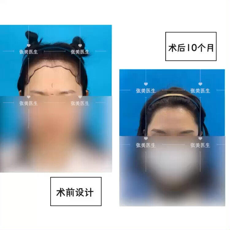 視頻封面