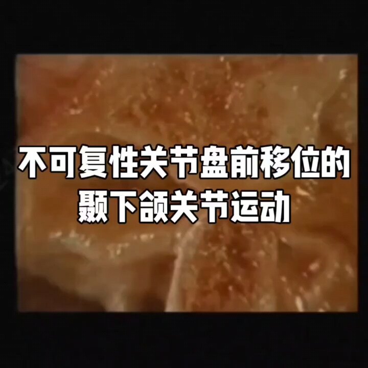 默认图片