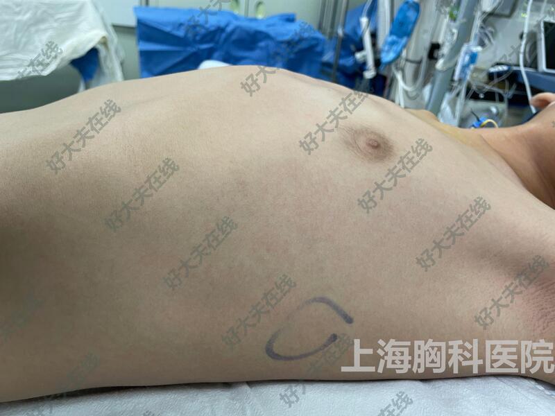 圖文圖片