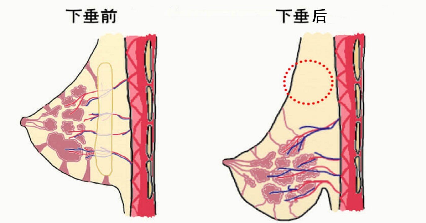 乳房按摩到底可不可取?