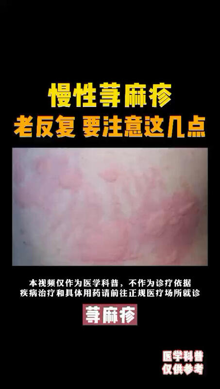 視頻封面