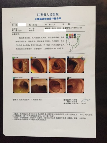 肠息肉活检报告图片