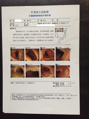 肠道息肉多发图片