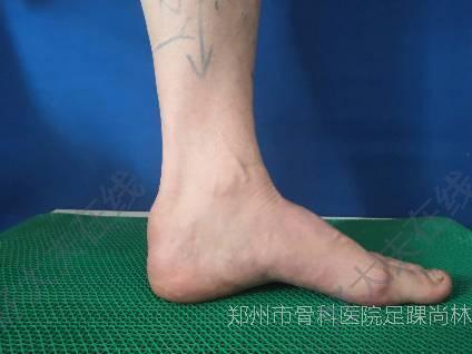 圖文圖片
