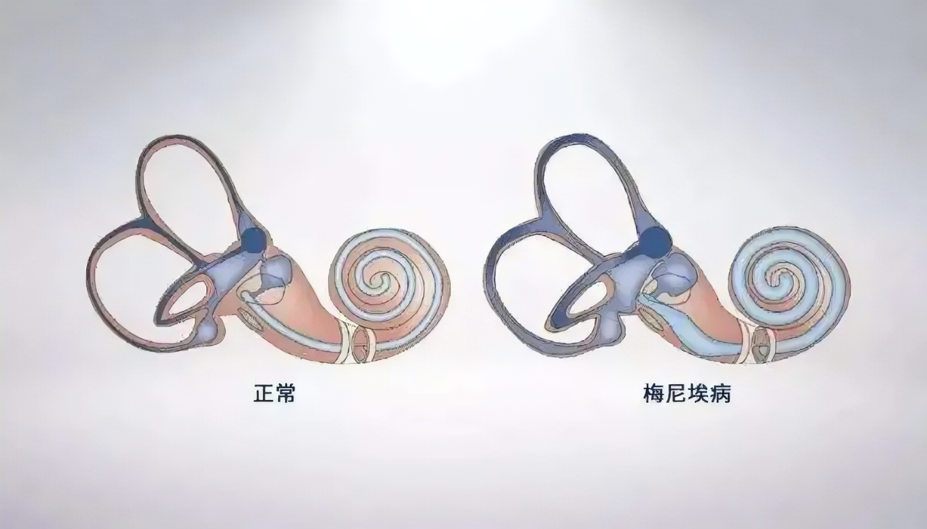 圖文圖片