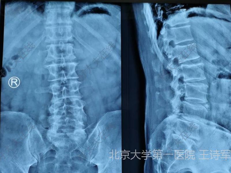 圖文圖片