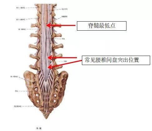 人體脊髓下端逐漸變細呈圓錐狀,位於l1椎體範圍為多,脊髓圓錐以下的腰