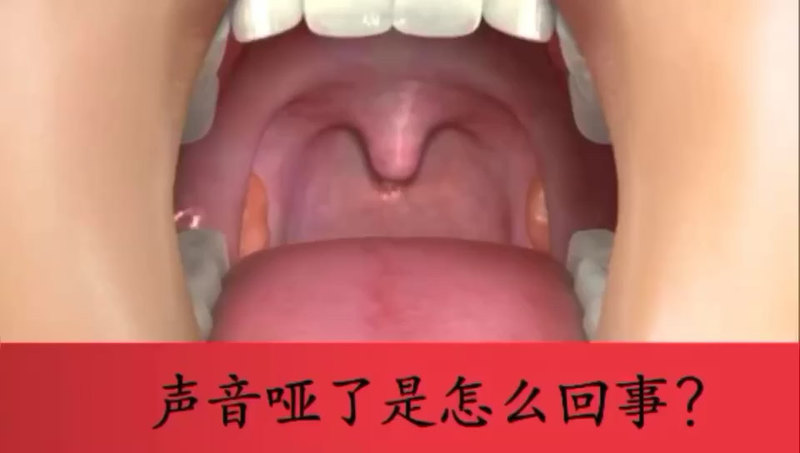 視頻封面