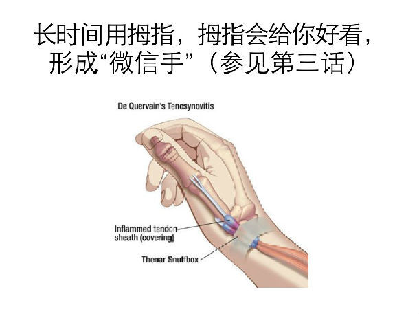 《关节疼痛怎么办?