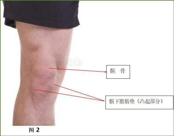 膝关节脂肪垫位置图图片