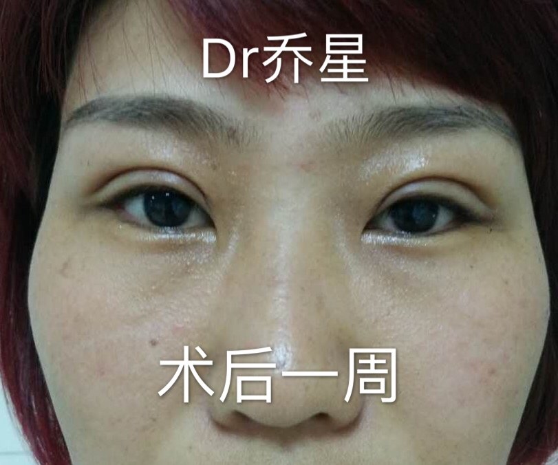 暂无
