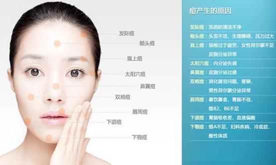 脸上不同位置长痘的原因