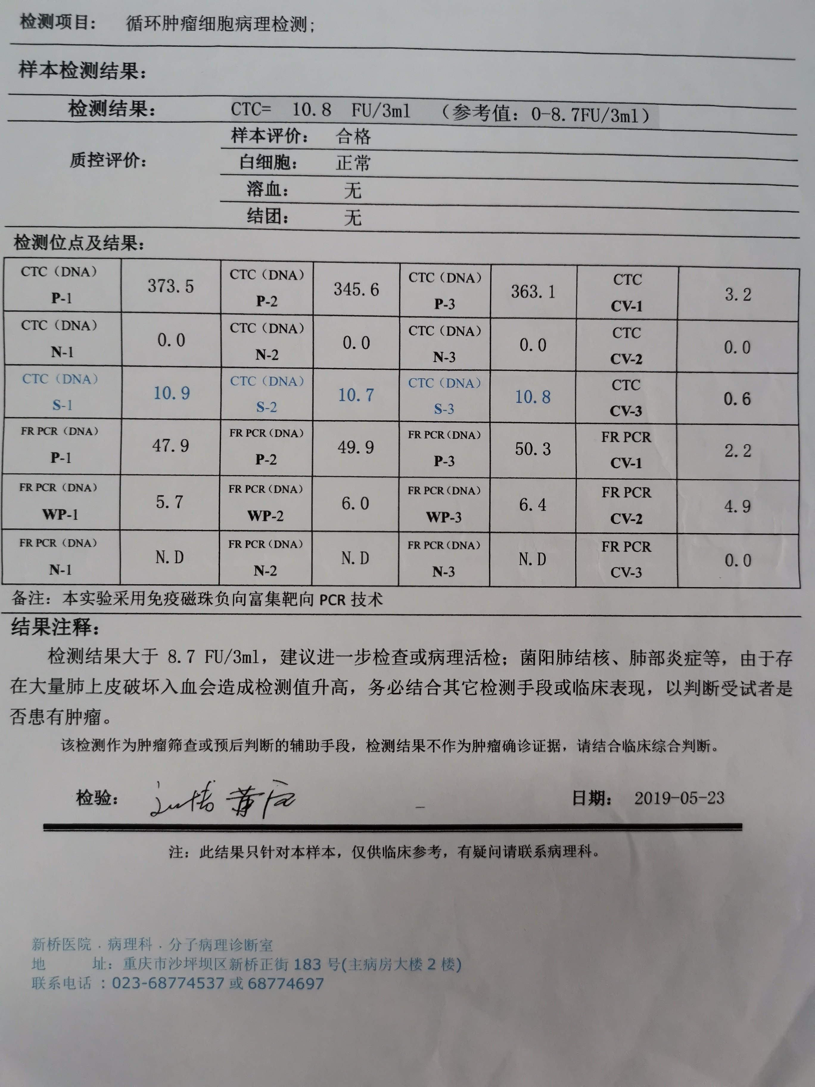 ctc对肺小结节的性质判断靠谱吗