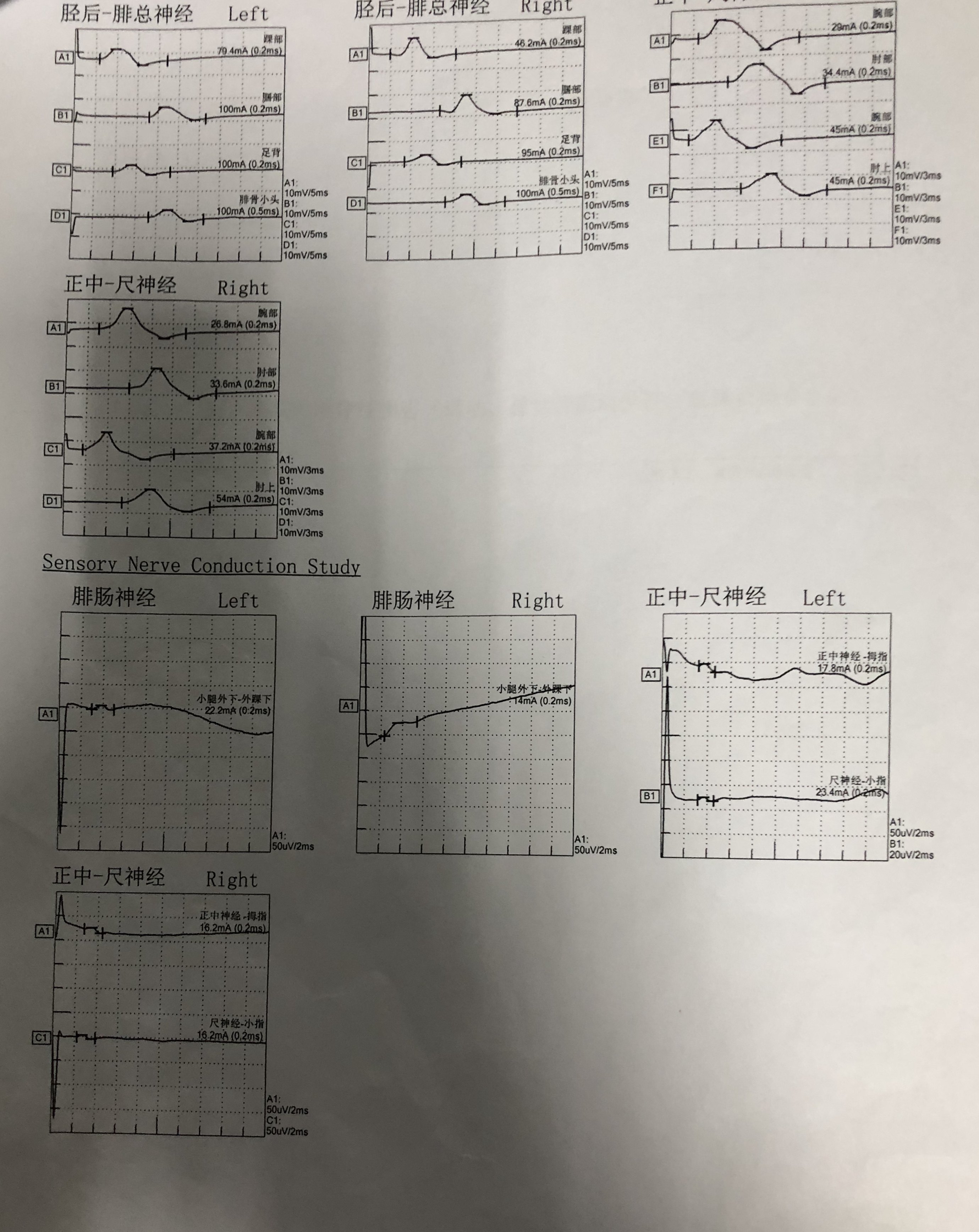 肌电图检测参考值图片