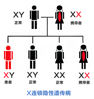 进行性肌营养不良遗传吗遗传方式是什么