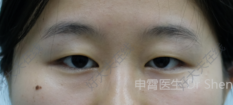 圖文圖片