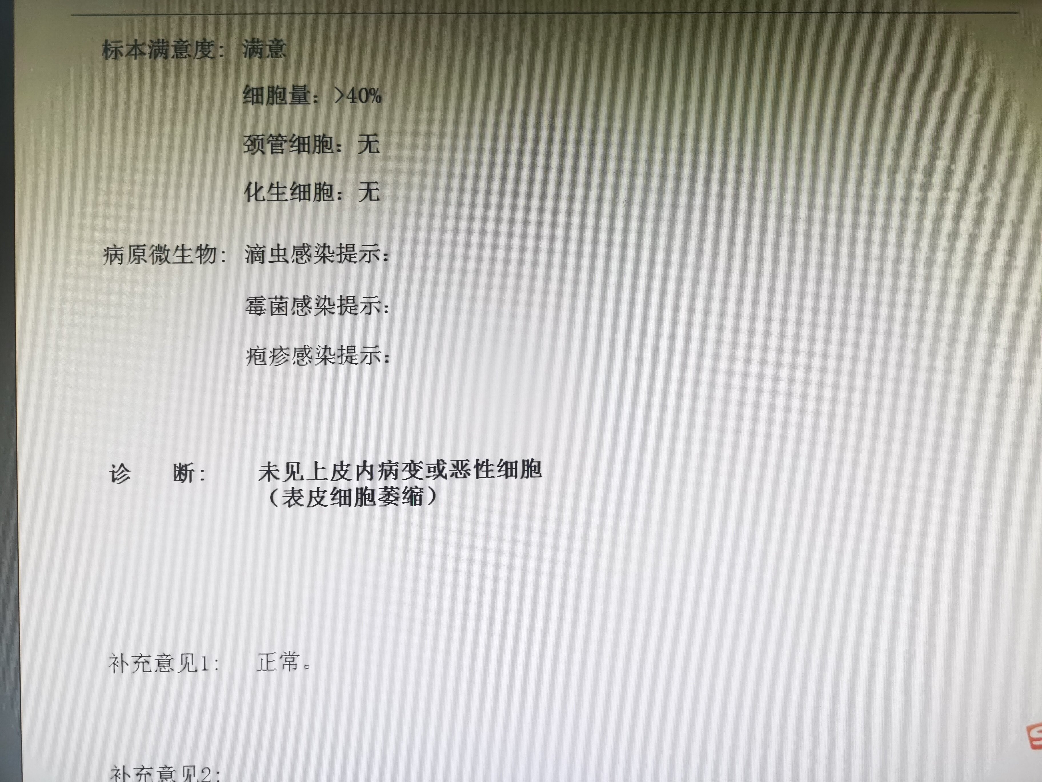 一分钟读懂宫颈液基细胞学(tct)报告 - 好大夫在线