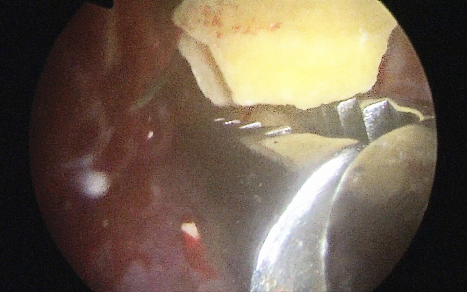 2020-11-04_1019[00_15_26][20201105-172954-0].jpg