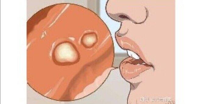 圖文圖片