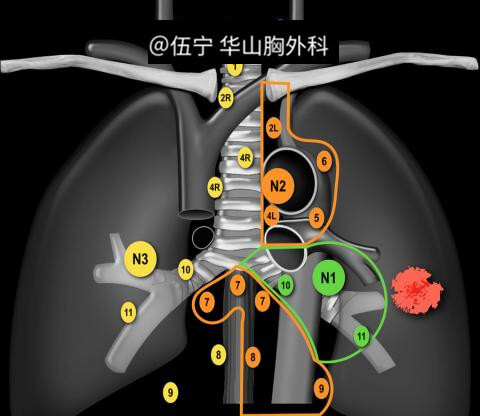 肺门淋巴结解剖图图片