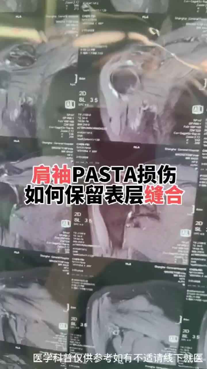 視頻封面