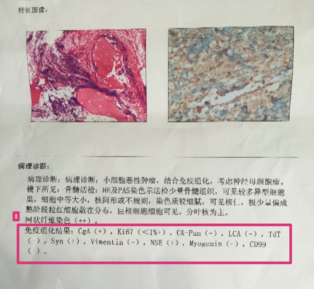 病理报告中免疫组化的必要性_病理诊断_病理诊断介绍 - 好大夫在线