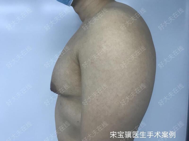 圖文圖片