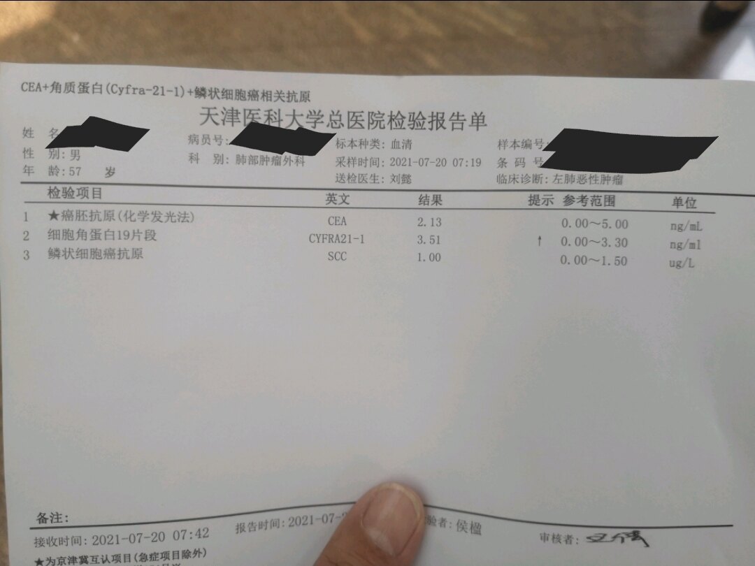 刘懿博士说肺癌(二三五三)肺癌术后复查,肿瘤标志物要对比看才行_肺癌