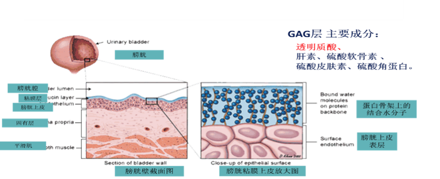 膀胱炎_症状表现_治疗方式 - 好大夫在线