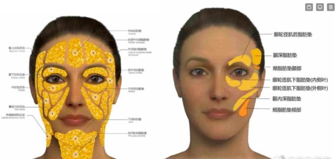 最近几年国际面部年轻化的热点 是面部浅层脂肪室的雕刻和移植.