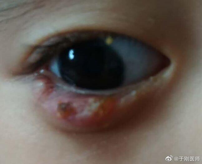 圖文圖片