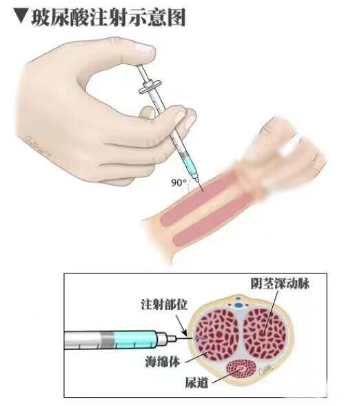 圖文圖片