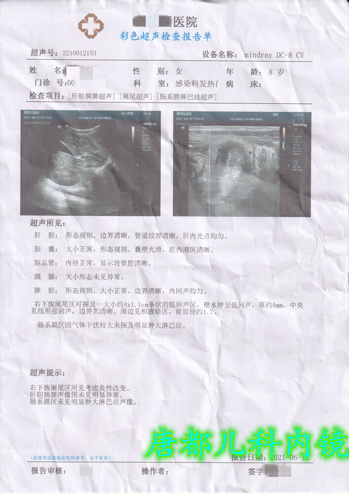 阑尾炎的超声报告模板图片