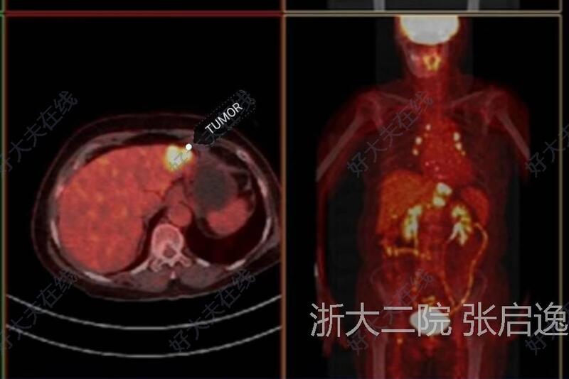 圖文圖片