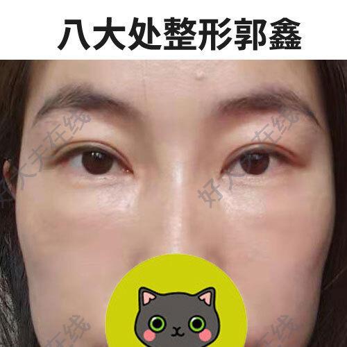 圖文圖片