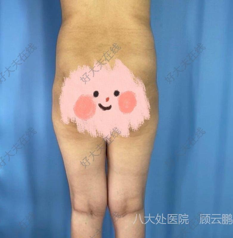 圖文圖片