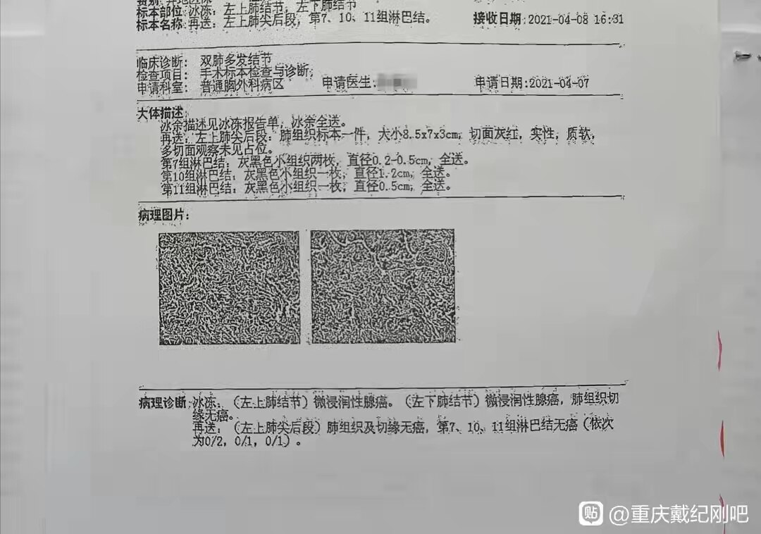 广州患者8mm和5mm肺结节的坎坷求医路 - 好大夫在线