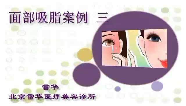 默认图片