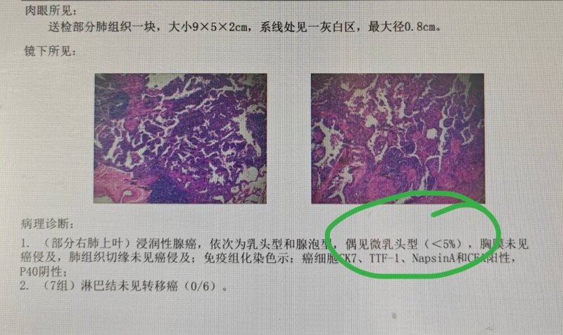 圖文圖片