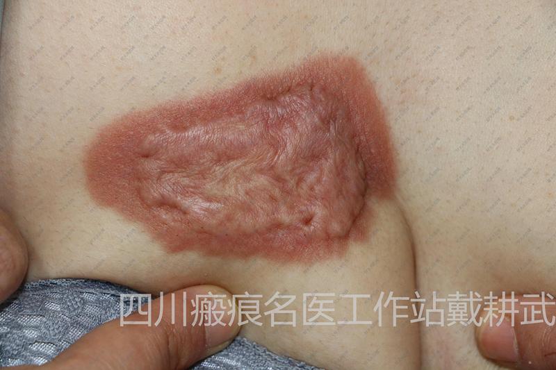圖文圖片