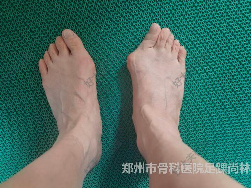 圖文圖片