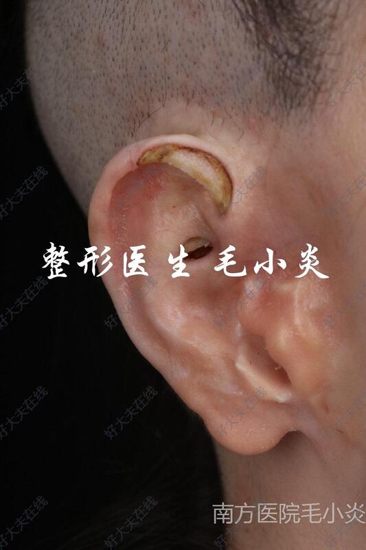 圖文圖片