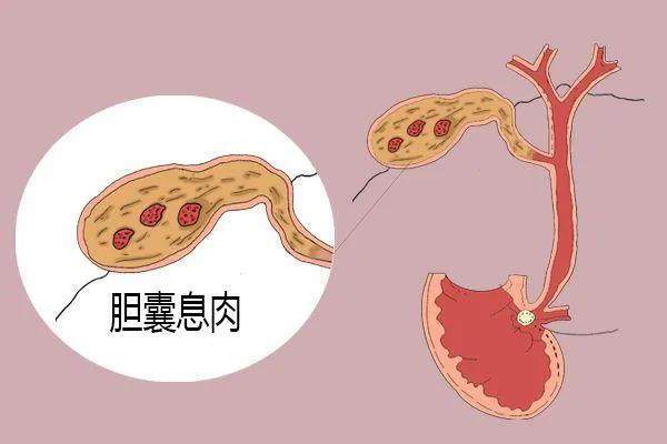 圖文圖片