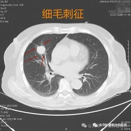 圖文圖片