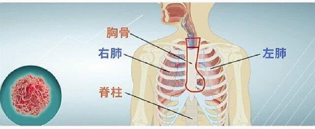 圖文圖片