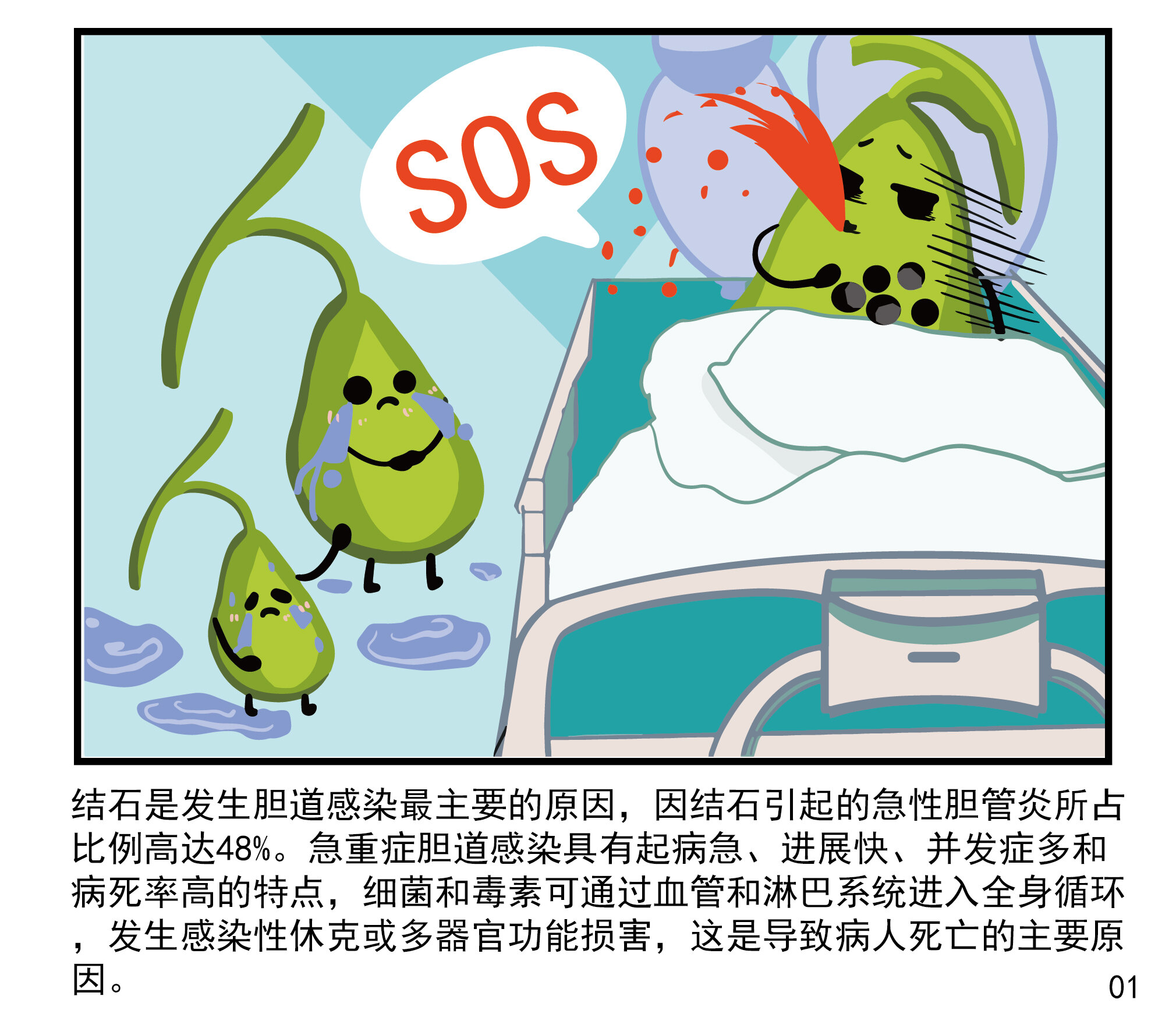 胆囊结石的并发症:胆道感染_胆道感染_发病原因_症状表现_治疗方式