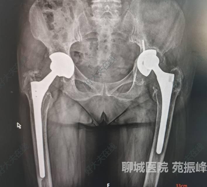 圖文圖片