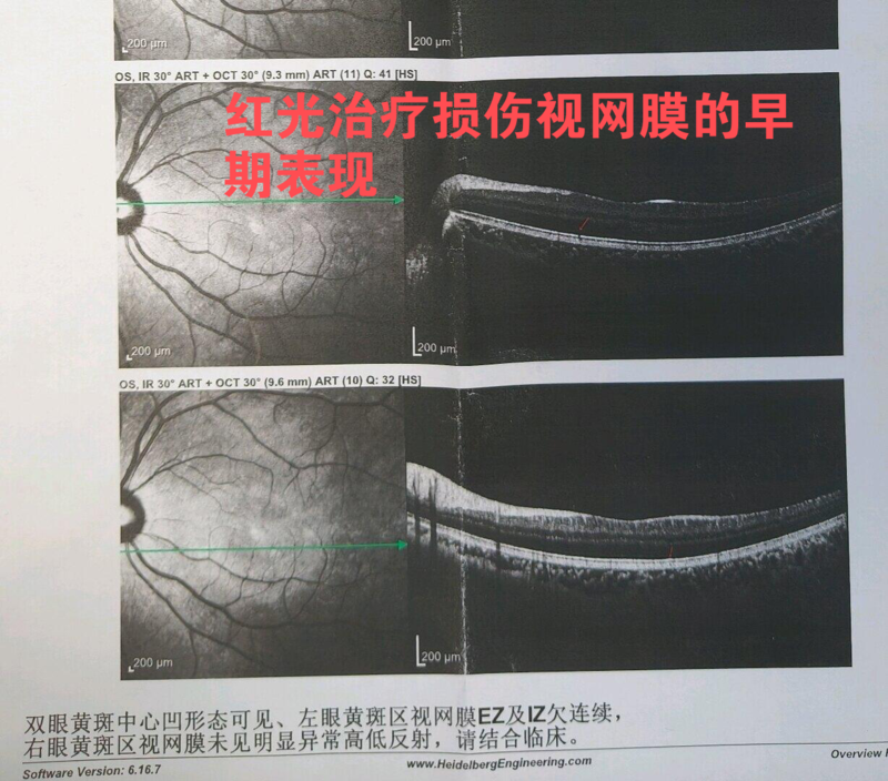 圖文圖片